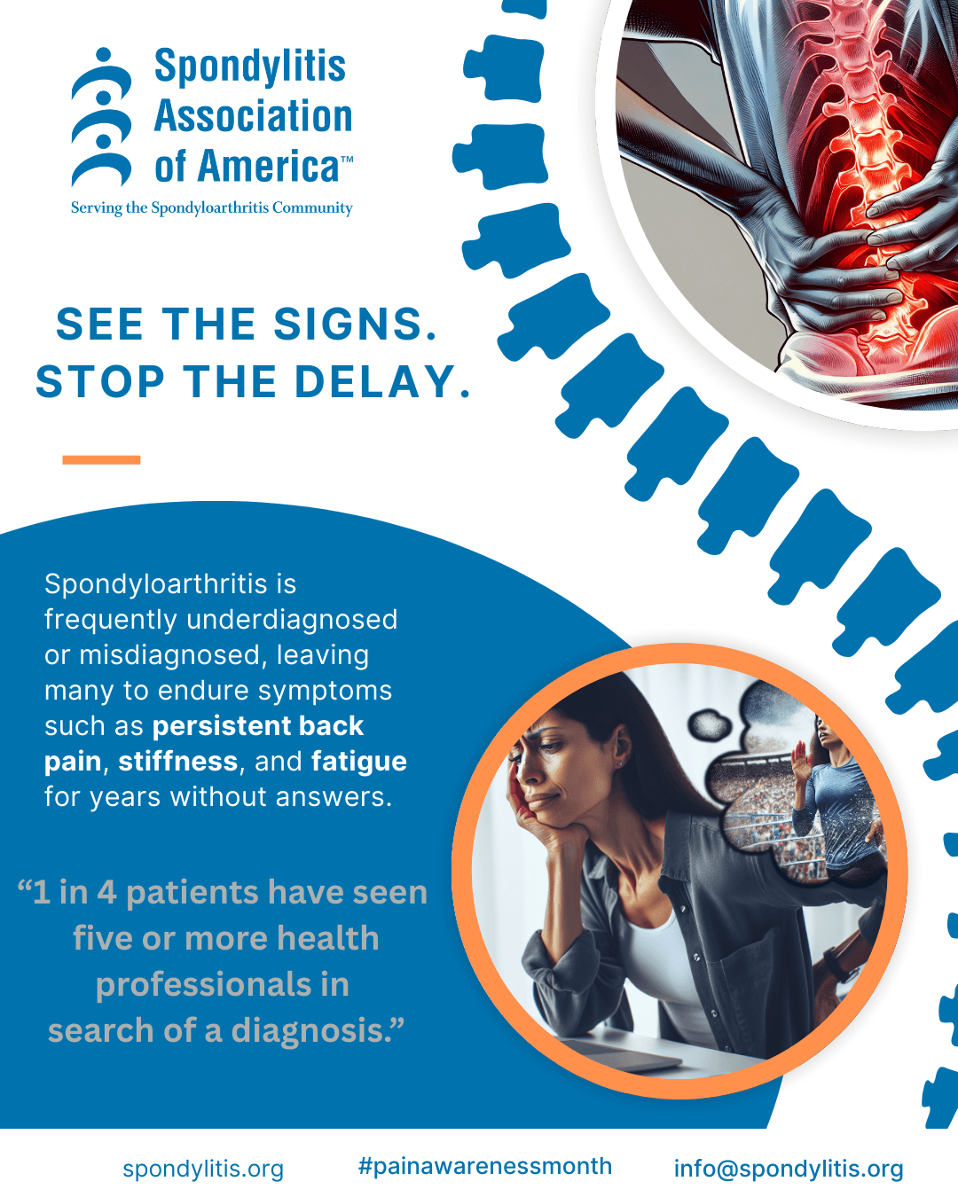 Spondylitis Association of America Launches "See the Signs. Stop the Delay." National Awareness Campaign to Reduce Misdiagnosis and Delays in Spondyloarthritis Care